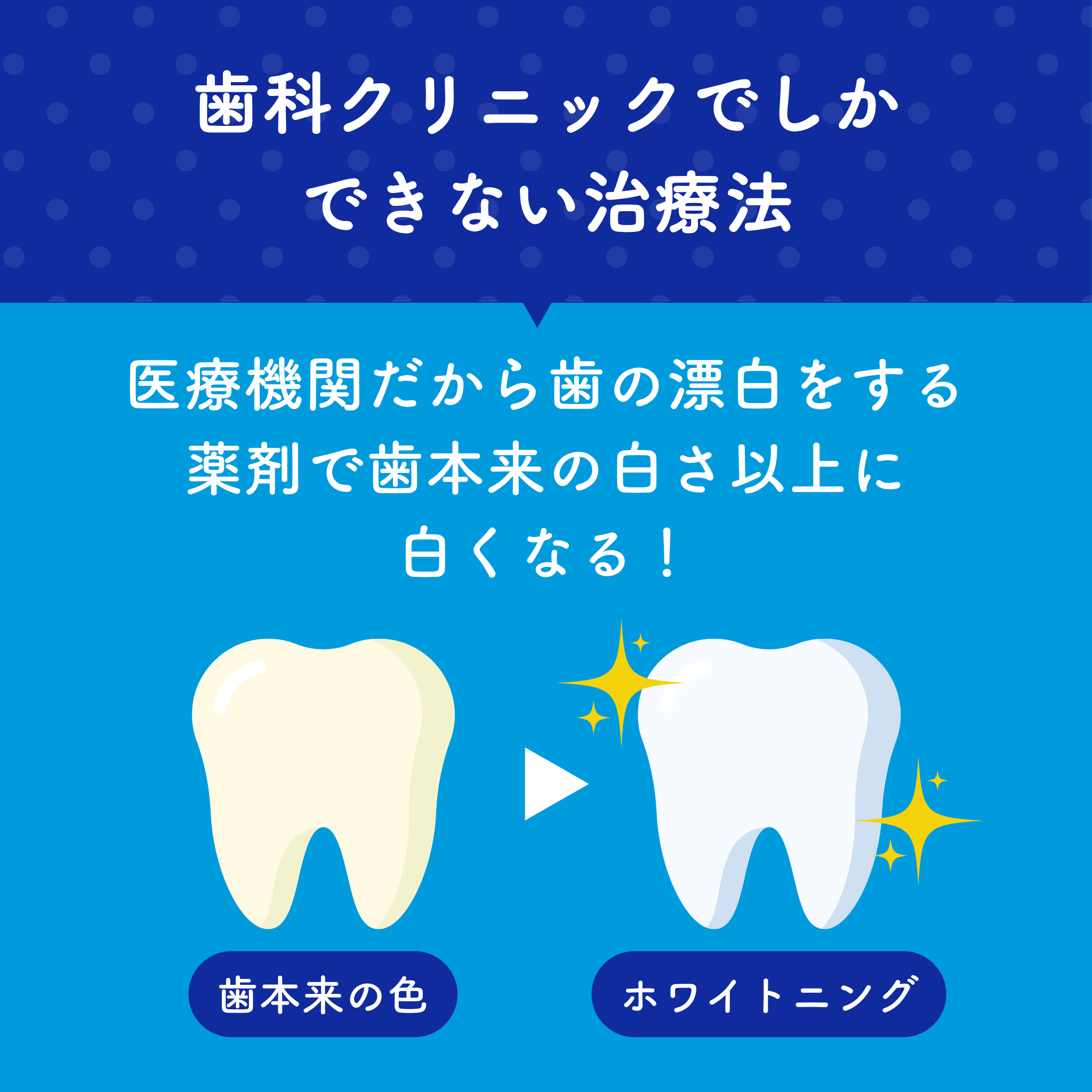 オフィス ホワイトニング 特別料金チケット 50%割引！（恵比寿店 駅から徒歩1分）